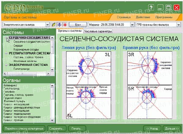 GDV Screening (ГРВ скрининг) GDV Screening (ГРВ скрининг) - программа для прибора ГРВ