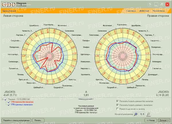GDV Diagram (ГРВ диаграмма) - программа для прибора ГРВ