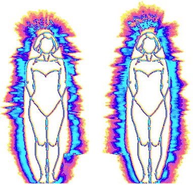 Аура пациента до и после терапии